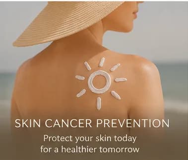 Prevención del cáncer de piel